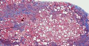 Foto: (OGphoto/istock)