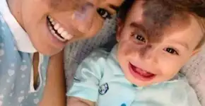 Imagem de mãe reproduzindo marca de nascença do filho viraliza