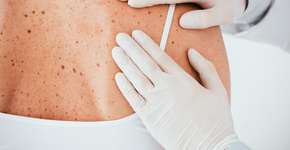 Remédios que não reagem bem com a exposição da pele ao sol