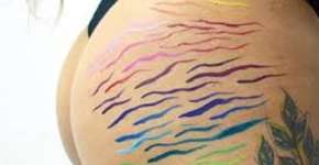 Foto: (Imagem sem texto alternativo disponivel ID [1848973])