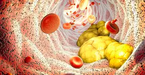 Foto: (iStock/Naeblys)