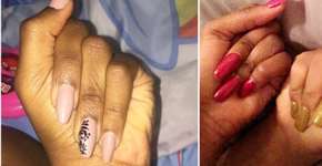 Mulher viraliza ao usar truque para ‘esconder’ um de seus dedos