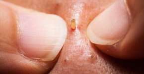 Foto: (reprodução/youtube)