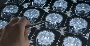 Foto: (haydenbird/istock)