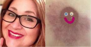 Mulher com câncer de mama critica Facebook por ter excluído foto de seio