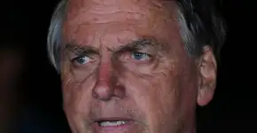 Bolsonaro com erisipela: foto mostra como está ferimento na perna