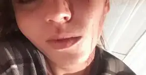 Traída, jovem pede fim do relacionamento e é agredida em Caxias