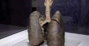 Foto: (Imagem sem texto alternativo disponivel ID [1844596])