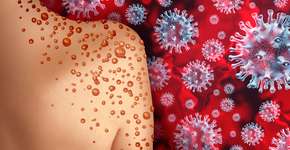 Foto: (wildpixel/istock)