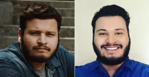 Ex-BBB Victor Hugo faz harmonização facial para reduzir bochechas