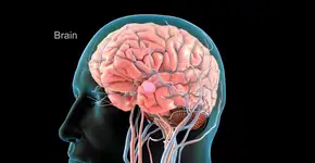 Dor de cabeça pode ser sintoma de aneurisma cerebral; saiba quando isso pode acontecer