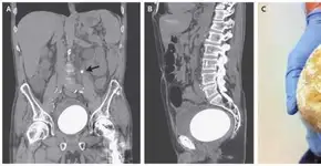 Foto: (Imagem sem texto alternativo disponivel ID [1488841])