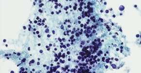 Foto: (OGphoto/istock)