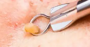 Foto: (Imagem sem texto alternativo disponivel ID [864749])