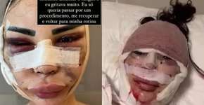 Modelo brasileira faz denúncia de maus-tratos na Turquia