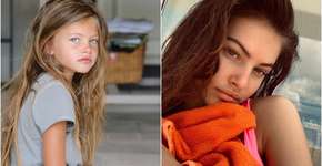 Garota ‘mais bonita do mundo’ passa por cirurgias de emergência