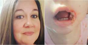 Foto: (Imagem sem texto alternativo disponivel ID [1541710])