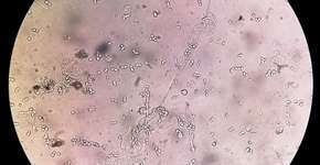 Foto: (Md Saiful Islam Khan/istock)