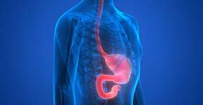 Aprovada pela Anvisa, nova redução de estômago já é feita em SP