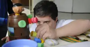 Estudo mostra como apagar o cromossomo extra da Síndrome de Down