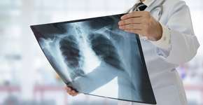 Foto: (Getty Images/iStockphoto)