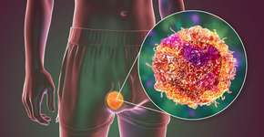 Foto: (iStock/Dr_Microbe)