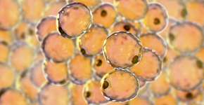 Foto: (Dr_Microbe/istock)