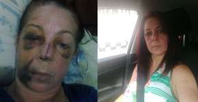 PMs são investigados por agredirem mulher durante blitz em Bauru