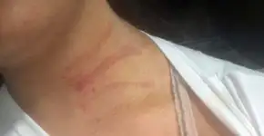 No Rio, jovem é torturada e estuprada por ex que não aceitava término