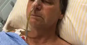 Bolsonaro retira dreno e passa para dieta leve, diz boletim