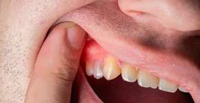 Foto: (Henadzi Pechan/istock)