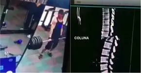 Homem parte a coluna em duas ao levantar peso na academia