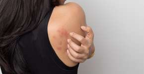 Foto: (chokja/istock)