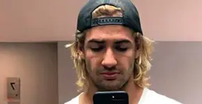 Após comparação inusitada com Fiorella, Pato muda o visual