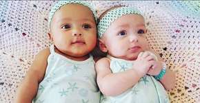 1 em cada 500: caso raro de gêmeas birraciais encanta a internet