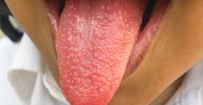 Foto: (reprodução/New England Journal of Medicine)