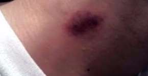 Foto: (Imagem sem texto alternativo disponivel ID [1129347])