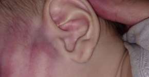 Pai que agrediu bebê diz ter batido ‘sem intenção de machucar’