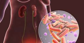 Fruta que ajuda a prevenir infecção urinária para incluir na dieta