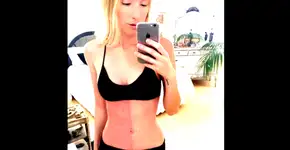 2 em 1: ela descobriu que ‘mancha’ no corpo é irmã que não nasceu