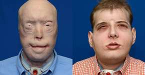 Foto: (Imagem sem texto alternativo disponivel ID [1834847])