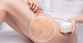 Foto: (iStock/dimid_86)