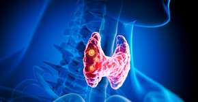 Foto: (iStock/peterschreiber.media)