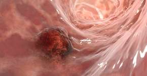 Foto: (Dr_Microbe/istock)