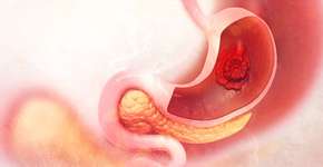 Foto: (Mohammed Haneefa Nizamudeen/istock)