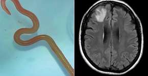 Foto: (Canberra Health)