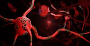 Foto: (Chinnachart Martmoh/istock)