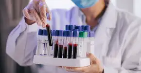 Foto: (Marcus Chung/istock)