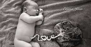 Foto que mostra recém-nascido com cordão umbilical e placenta faz sucesso na internet