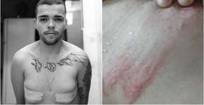 ‘É uma luta diária’, diz trans que criou rifa para mastectomia